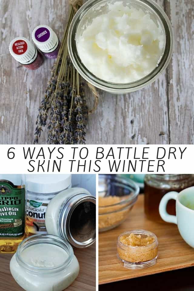 6 Ways To Battle Dry Skin This Winter